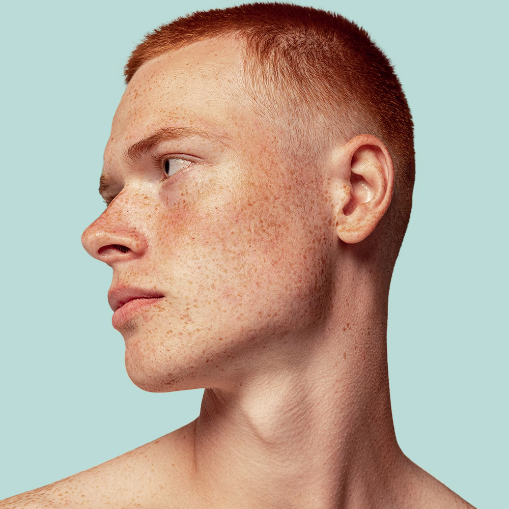Person with short red hair and freckles.