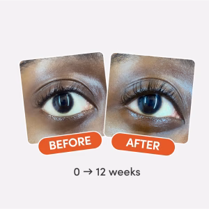 Before and after eyelash growth