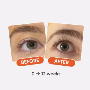 Before and after eye close-up