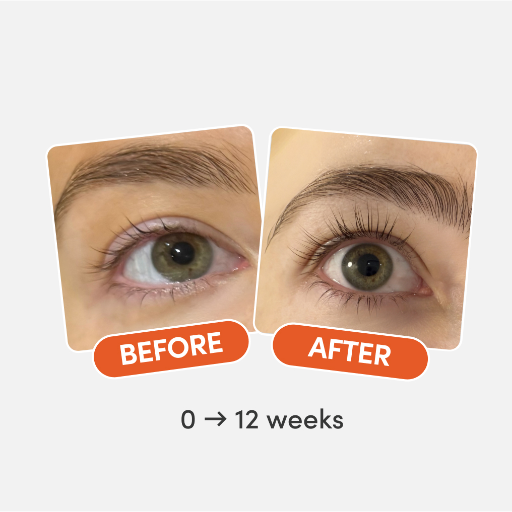 Before and after eye close-up